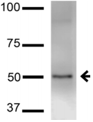 KCNK3 / OAT1 Antibody - Detection of TASK1 in rat brain lysate with TASK1 Potassium Channel Monoclonal Antibody at 1ug/ml.