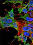 KCNK3 / OAT1 Antibody - Detection of TASK1 in neuroblastoma cell line SK-N-BE with TASK1 Potassium Channel Monoclonal Antibody at 10ug/ml: DAPI (blue) nuclear stain, Texas Red F actin stain, ATTO 488 (green) SHANK1/SHANK3 stain.