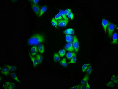 KCNK3 / OAT1 Antibody - Immunofluorescence staining of Hela cells with KCNK3 Antibody at 1:100, counter-stained with DAPI. The cells were fixed in 4% formaldehyde, permeabilized using 0.2% Triton X-100 and blocked in 10% normal Goat Serum. The cells were then incubated with the antibody overnight at 4°C. The secondary antibody was Alexa Fluor 488-congugated AffiniPure Goat Anti-Rabbit IgG(H+L).