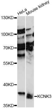 KCNK3 / OAT1 Antibody - Western blot analysis of extracts of various cell lines, using KCNK3 antibody at 1:1000 dilution. The secondary antibody used was an HRP Goat Anti-Rabbit IgG (H+L) at 1:10000 dilution. Lysates were loaded 25ug per lane and 3% nonfat dry milk in TBST was used for blocking. An ECL Kit was used for detection and the exposure time was 10s.