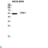 KCNK3 / OAT1 Antibody - Western Blot (WB) analysis of Mouse Brain using TASK-1 antibody.