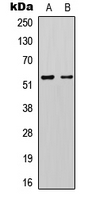 KCNK3 / OAT1 Antibody - Western blot analysis of KCNK3 expression in Jurkat (A); mouse brain (B) whole cell lysates.
