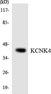 KCNK4 / TRAAK Antibody - Western blot analysis of the lysates from HUVECcells using KCNK4 antibody.