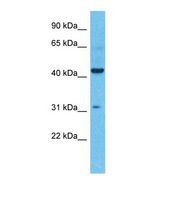 KCNK4 / TRAAK Antibody - Western blot of Human Colorectal Tumor. KCNK4 antibody dilution 1.0 ug/ml.  This image was taken for the unconjugated form of this product. Other forms have not been tested.