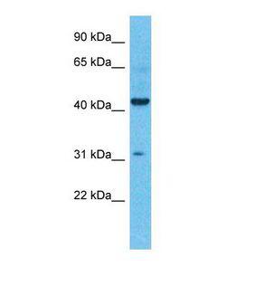 KCNK4 / TRAAK Antibody - Western blot of Human Colorectal Tumor. KCNK4 antibody dilution 1.0 ug/ml.  This image was taken for the unconjugated form of this product. Other forms have not been tested.