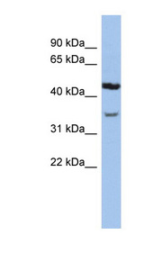 KCNK4 / TRAAK Antibody - KCNK4 antibody Western blot of Jurkat lysate. This image was taken for the unconjugated form of this product. Other forms have not been tested.