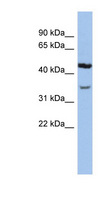 KCNK4 / TRAAK Antibody - KCNK4 antibody Western blot of Jurkat lysate. This image was taken for the unconjugated form of this product. Other forms have not been tested.