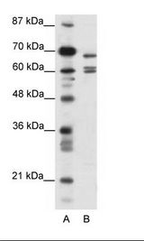 KCNK5 / TASK2 Antibody - A: Marker, B: HepG2 Cell Lysate.  This image was taken for the unconjugated form of this product. Other forms have not been tested.