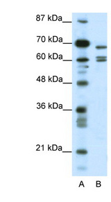 KCNK5 / TASK2 Antibody - KCNK5 antibody Western blot of HepG2 cell lysate. This image was taken for the unconjugated form of this product. Other forms have not been tested.