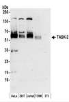 KCNK5 / TASK2 Antibody - Detection of Human and Mouse TASK-2 by Western Blot. Samples: Whole cell lysate (50 ug) prepared using NETN buffer from HeLa, 293T, Jurkat, mouse TCMK-1, and mouse NIH3T3 cells. Antibodies: Affinity purified rabbit anti-TASK-2 antibody used for WB at 0.4 ug/ml. Detection: Chemiluminescence with an exposure time of 3 minutes.