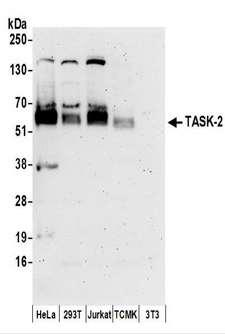 KCNK5 / TASK2 Antibody - Detection of Human and Mouse TASK-2 by Western Blot. Samples: Whole cell lysate (50 ug) prepared using NETN buffer from HeLa, 293T, Jurkat, mouse TCMK-1, and mouse NIH3T3 cells. Antibodies: Affinity purified rabbit anti-TASK-2 antibody used for WB at 0.4 ug/ml. Detection: Chemiluminescence with an exposure time of 3 minutes.