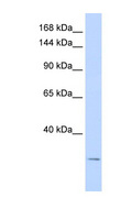 KCNK6 / TWIK-2 Antibody - KCNK6 antibody Western blot of HeLa lysate. This image was taken for the unconjugated form of this product. Other forms have not been tested.