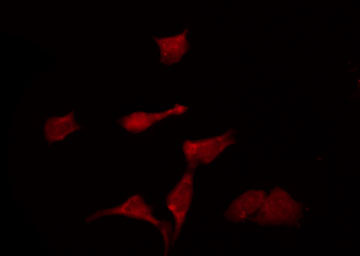 KCNK6 / TWIK-2 Antibody - Staining HeLa cells by IF/ICC. The samples were fixed with PFA and permeabilized in 0.1% Triton X-100, then blocked in 10% serum for 45 min at 25°C. The primary antibody was diluted at 1:200 and incubated with the sample for 1 hour at 37°C. An Alexa Fluor 594 conjugated goat anti-rabbit IgG (H+L) Ab, diluted at 1/600, was used as the secondary antibody.