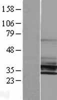 KCNK6 / TWIK-2 Protein - Western validation with an anti-DDK antibody * L: Control HEK293 lysate R: Over-expression lysate