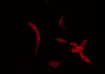 KCNK7 / K2p7.1 Antibody - Staining HeLa cells by IF/ICC. The samples were fixed with PFA and permeabilized in 0.1% Triton X-100, then blocked in 10% serum for 45 min at 25°C. The primary antibody was diluted at 1:200 and incubated with the sample for 1 hour at 37°C. An Alexa Fluor 594 conjugated goat anti-rabbit IgG (H+L) Ab, diluted at 1/600, was used as the secondary antibody.