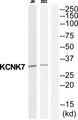 KCNK7 / K2p7.1 Antibody - Western blot analysis of extracts from Jurkat/293 cells, using KCNK7 antibody.