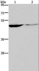 KCNK9 / TASK3 Antibody - Western blot analysis of Human paraneoplastic and normal kidney tissue, using KCNK9 Polyclonal Antibody at dilution of 1:650.