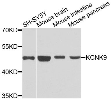 KCNK9 / TASK3 Antibody - Western blot analysis of extracts of various cell lines, using KCNK9 antibody at 1:1000 dilution. The secondary antibody used was an HRP Goat Anti-Rabbit IgG (H+L) at 1:10000 dilution. Lysates were loaded 25ug per lane and 3% nonfat dry milk in TBST was used for blocking. An ECL Kit was used for detection and the exposure time was 30s.