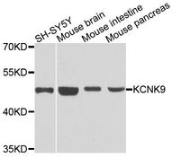 KCNK9 / TASK3 Antibody - Western blot analysis of extracts of various cell lines, using KCNK9 antibody at 1:1000 dilution. The secondary antibody used was an HRP Goat Anti-Rabbit IgG (H+L) at 1:10000 dilution. Lysates were loaded 25ug per lane and 3% nonfat dry milk in TBST was used for blocking. An ECL Kit was used for detection and the exposure time was 30s.