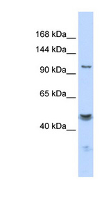 KCNMA1 / BK Antibody - KCNMA1 antibody Western blot of Fetal Liver lysate. This image was taken for the unconjugated form of this product. Other forms have not been tested.
