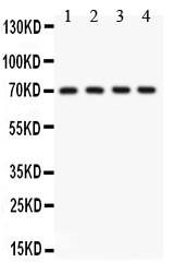 KCNMA1 / BK Antibody - KCNMA1antibody Western blot. All lanes: Anti KCNMA1 at 0.5 ug/ml. Lane 1: Rat Brain Tissue Lysate at 50 ug. Lane 2: Rat Testis Tissue Lysate at 50 ug. Lane 3: Mouse Brain Tissue Lysate at 50 ug. Lane 4: Mouse Testis Tissue Lysate at 50 ug. Predicted band size: 137 kD. Observed band size: 70 kD.