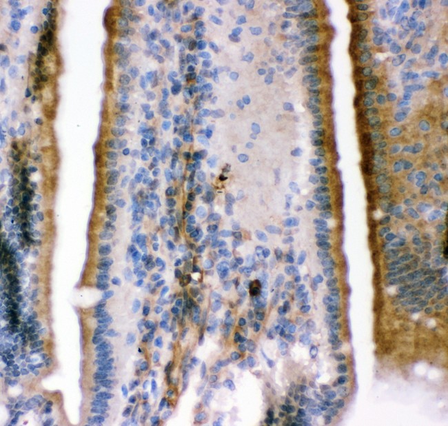 KCNMA1 / BK Antibody - KCNMA1antibody IHC-paraffin: Mouse Intestine Tissue.