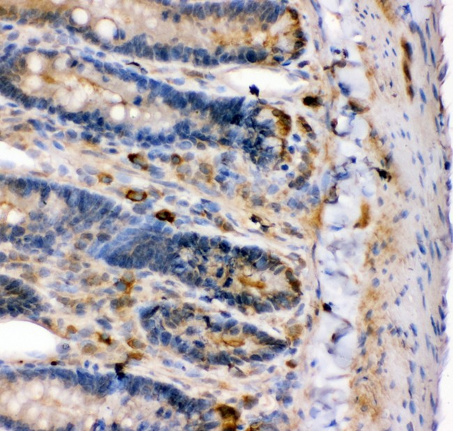 KCNMA1 / BK Antibody - KCNMA1antibody IHC-paraffin: Rat Intestine Tissue.