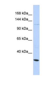 KCNMA1 / BK Antibody - KCNMA1 antibody Western blot of HeLa lysate. This image was taken for the unconjugated form of this product. Other forms have not been tested.