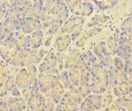 KCNMA1 / BK Antibody - Immunohistochemistry of paraffin-embedded human pancreatic tissue using KCNMA1 Antibody at dilution of 1:100