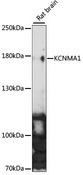 KCNMA1 / BK Antibody - Western blot analysis of extracts of Rat brain, using KCNMA1 antibody at 1:1000 dilution. The secondary antibody used was an HRP Goat Anti-Rabbit IgG (H+L) at 1:10000 dilution. Lysates were loaded 25ug per lane and 3% nonfat dry milk in TBST was used for blocking. An ECL Kit was used for detection and the exposure time was 90s.