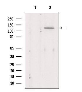 KCNMA1 / BK Antibody - Western blot analysis of extracts of mouse Myeloma cells using MaxiK alpha antibody. Lane 1 was treated with the blocking peptide.