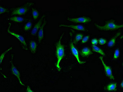 KCNMB1 Antibody - Immunofluorescent analysis of Hela cells using KCNMB1 Antibody at dilution of 1:100 and Alexa Fluor 488-congugated AffiniPure Goat Anti-Rabbit IgG(H+L)