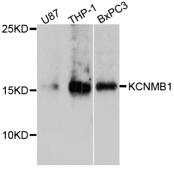 KCNMB1 Antibody - Western blot analysis of extracts of various cell lines, using KCNMB1 antibody at 1:1000 dilution. The secondary antibody used was an HRP Goat Anti-Rabbit IgG (H+L) at 1:10000 dilution. Lysates were loaded 25ug per lane and 3% nonfat dry milk in TBST was used for blocking. An ECL Kit was used for detection and the exposure time was 90s.
