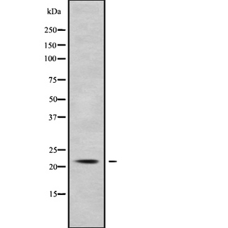 KCNMB1 Antibody - Western blot analysis of KCNMB1 using COS7 whole cells lysates