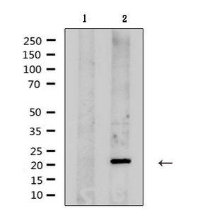 KCNMB1 Antibody - Western blot analysis of extracts of rat brain tissue using KCNMB1 antibody. Lane 1 was treated with the antigen-specific peptide.