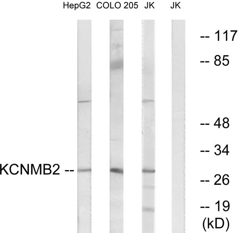 KCNMB2 Antibody - Western blot analysis of lysates from Jurkat, COLO, and HepG2 cells, using KCNMB2 Antibody. The lane on the right is blocked with the synthesized peptide.