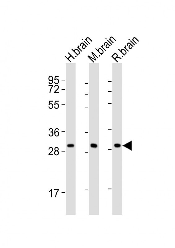 KCNMB2 Antibody - All lanes : Anti-KCNMB2 Antibody at 1:2000 dilution Lane 1: human brain lysates Lane 2: mouse brain lysates Lane 3: rat brain lysates Lysates/proteins at 20 ug per lane. Secondary Goat Anti-Rabbit IgG, (H+L), Peroxidase conjugated at 1/10000 dilution Predicted band size : 27 kDa Blocking/Dilution buffer: 5% NFDM/TBST.
