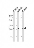 KCNMB2 Antibody - All lanes : Anti-KCNMB2 Antibody at 1:2000 dilution Lane 1: human brain lysates Lane 2: mouse brain lysates Lane 3: rat brain lysates Lysates/proteins at 20 ug per lane. Secondary Goat Anti-Rabbit IgG, (H+L), Peroxidase conjugated at 1/10000 dilution Predicted band size : 27 kDa Blocking/Dilution buffer: 5% NFDM/TBST.