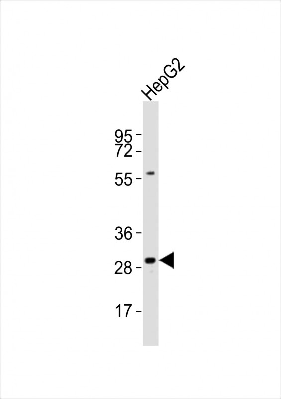 KCNMB2 Antibody - Anti-KCNMB2 Antibody at 1:1000 dilution + HepG2 whole cell lysates Lysates/proteins at 20 ug per lane. Secondary Goat Anti-Rabbit IgG, (H+L), Peroxidase conjugated at 1/10000 dilution Predicted band size : 27 kDa Blocking/Dilution buffer: 5% NFDM/TBST.