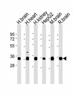 KCNMB2 Antibody - All lanes : Anti-KCNMB2 Antibody at 1:2000 dilution Lane 1: human brain lysates Lane 2: human heart lysates Lane 3: human kidney lysates Lane 4: HepG2 whole cell lysates Lane 5: mouse brain lysates Lane 6: rat brain lysates Lysates/proteins at 20 ug per lane. Secondary Goat Anti-Rabbit IgG, (H+L), Peroxidase conjugated at 1/10000 dilution Predicted band size : 27 kDa Blocking/Dilution buffer: 5% NFDM/TBST.
