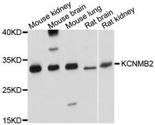 KCNMB2 Antibody - Western blot analysis of extracts of various cell lines, using KCNMB2 antibody at 1:1000 dilution. The secondary antibody used was an HRP Goat Anti-Rabbit IgG (H+L) at 1:10000 dilution. Lysates were loaded 25ug per lane and 3% nonfat dry milk in TBST was used for blocking. An ECL Kit was used for detection and the exposure time was 30s.