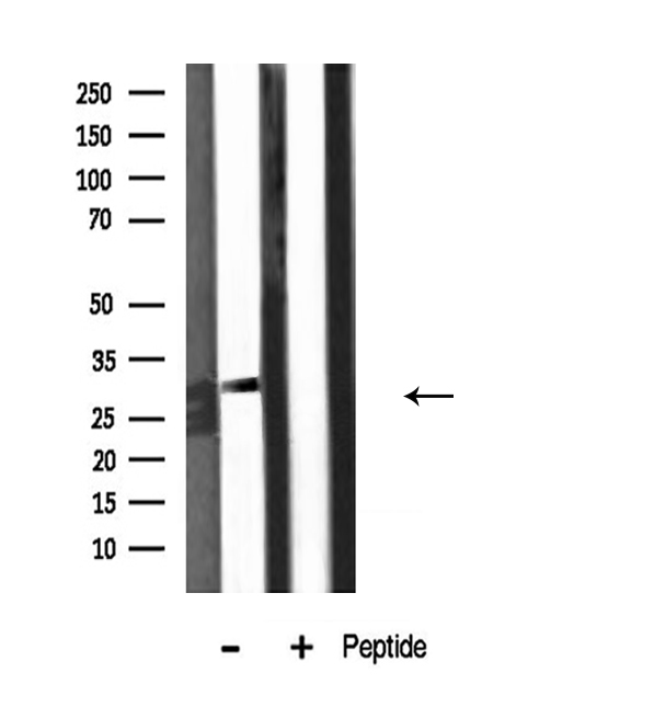 KCNMB2 Antibody - Western blot analysis of KCNMB2 expression in mouse brain lysate
