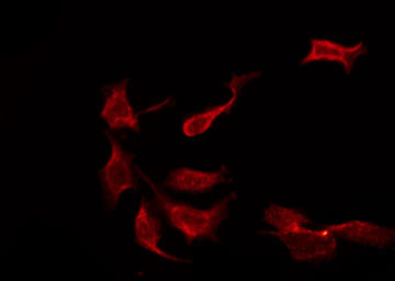 KCNMB2 Antibody - Staining HeLa cells by IF/ICC. The samples were fixed with PFA and permeabilized in 0.1% Triton X-100, then blocked in 10% serum for 45 min at 25°C. The primary antibody was diluted at 1:200 and incubated with the sample for 1 hour at 37°C. An Alexa Fluor 594 conjugated goat anti-rabbit IgG (H+L) Ab, diluted at 1/600, was used as the secondary antibody.