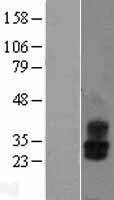 KCNMB2 Protein - Western validation with an anti-DDK antibody * L: Control HEK293 lysate R: Over-expression lysate