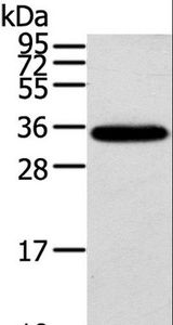KCNMB3 Antibody - Western blot analysis of Mouse brain tissue, using KCNMB3 Polyclonal Antibody at dilution of 1:300.