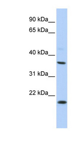 KCNMB3 Antibody - KCNMB3 antibody Western blot of HepG2 cell lysate. This image was taken for the unconjugated form of this product. Other forms have not been tested.