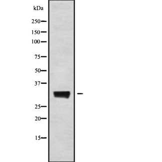 KCNMB3 Antibody - Western blot analysis of KCNMB3 using A549 whole cells lysates