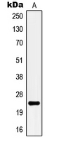 KCNMB4 Antibody - Western blot analysis of KCNMB4 expression in THP1 (A) whole cell lysates.