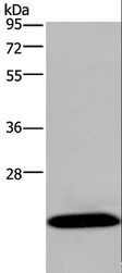 KCNMB4 Antibody - Western blot analysis of Mouse brain tissue, using KCNMB4 Polyclonal Antibody at dilution of 1:500.