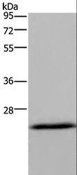 KCNMB4 Antibody - Western blot analysis of Mouse brain tissue, using KCNMB4 Polyclonal Antibody at dilution of 1:500.